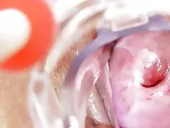 더러운 간호사 되 면 솔로